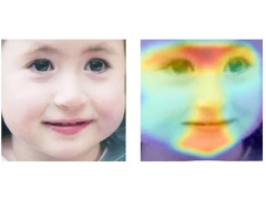 超过专业医生！AI识别遗传病准确率达91%