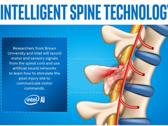AI向善 英特尔人工智能助瘫痪患者恢复运动功能