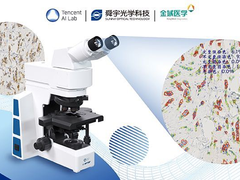 腾讯AI Lab 宣布中国首款智能显微镜获药监局批准进入临床应用