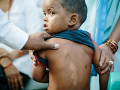 加速推进AI+医疗，微软如何助力全球公共健康？