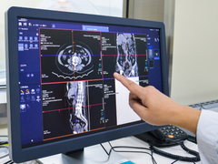智能缓存预取，深信服EDS存储为PACS注入新能量