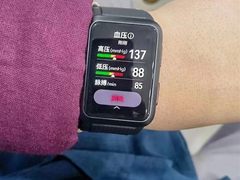 华为Watch D手表曝光 可测血压+ECG心电图测量